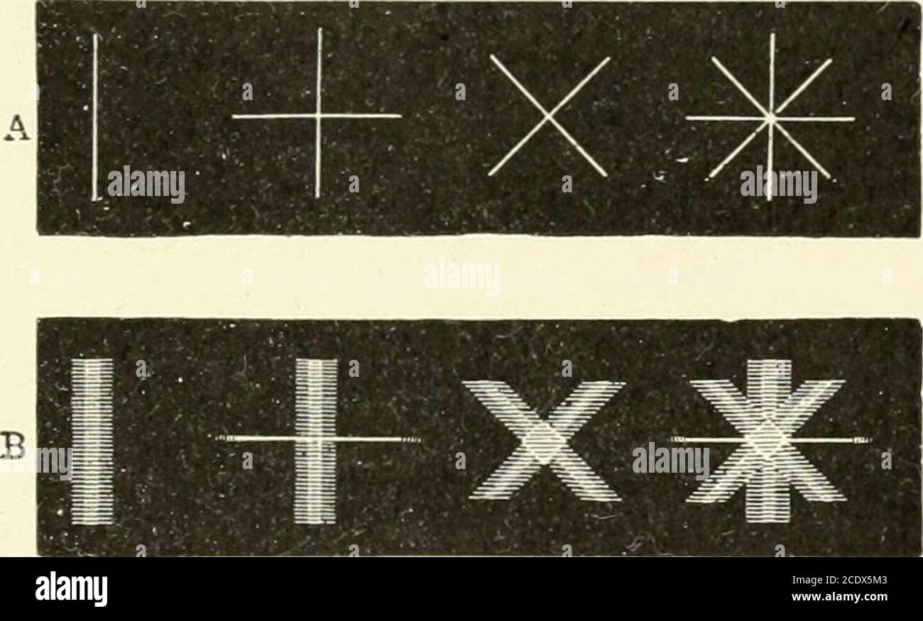 . Manuale di fisiologia di Kirkes. Distintamente allo stesso tempo. Questa condizione è DIFETTI NELL'APPARATO OTTICO 651 ulteriormente illustrato nella figura 465 che rappresenta la posizione /t mostrata nella figura 464. Miopia. Questa è la condizione di rifrazione dell'occhio in cui i parallelraggi sono portati a fuoco davanti alla retina, 4, figura 466. È duead un allungamento anormale del bulbo oculare, antero-posterioralmente, o ad un aumento della convessità delle superfici rifrangenti, o ad entrambe queste condizioni. I raggi paralleli sono messi a fuoco davanti alla retina e, incrociando, formano dei cerchi sul Foto Stock