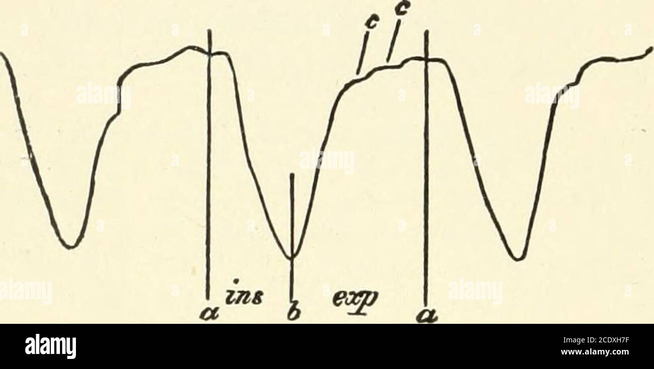 . Il manuale di fisiologia di Kirkes . e tambour è posto sulla parte del petto il movimento di cui si desidera registrare, e l'altro pulsante è fatto per premere sul lato corrispondente del petto, in modo che il petto è tenuto come betweena coppia di calibri. Il tamburello ricevente è collegato attraverso un pezzo a T con un recordingtambur di Marcis, e con un bulbo mediante il quale l'aria può essere schiacciata nella timpano. Una volta regolato, il tubo collegato alla sfera d'aria viene chiuso per mezzo di un morsetto a vite. Il movimento del torace viene quindi comunicato al tambour terecorante. A s Foto Stock