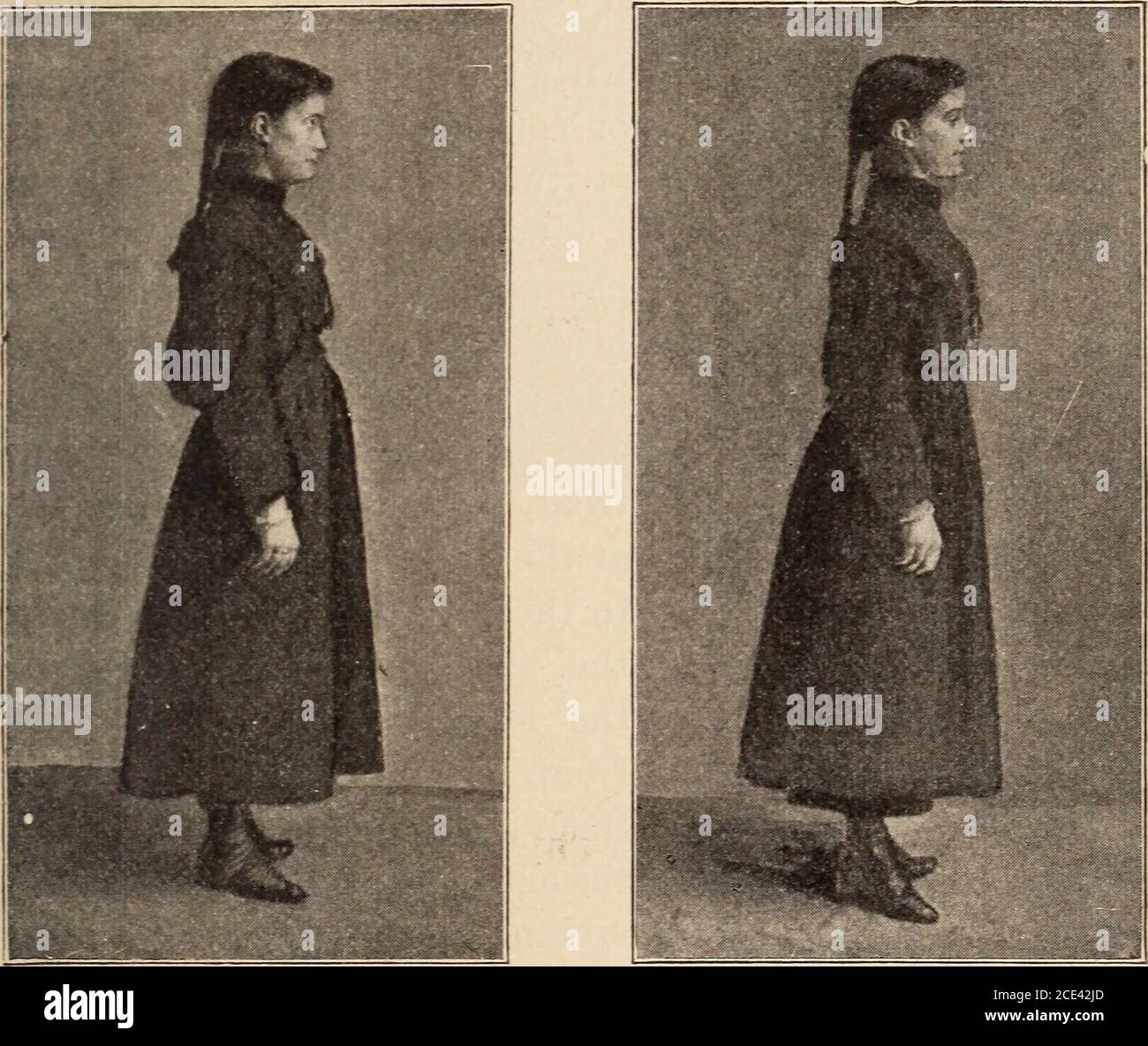 . Ginnastica scolastica con apparecchio di luce. Houklers indietro e tirare il mento dentro. Tali direzioni fanno sì che il bambino si autoconsci ; non lo fanno. Almeno nel bambino più giovane, producono il risultato desiderato, perché tali bambini sono notabili del controllo isolato delle parti denominate, e si producono altri difetti di postura - Come un attitudecon addome sporgente, ecc. lo stiramento, con la sua trazione rettilinea in linea con i diametri verticale e laterale del corpo, solleva e espande il petto e erige la spina dorsale senza questo sforzo dolorosamente auto-cosciente. Inoltre, un tale generalmuscul Foto Stock