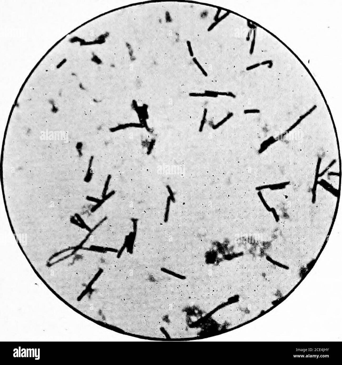 . microörganisms patogenica; un manuale pratico per studenti, medici, e operatori sanitari . ione che i bacilli saranno attivi nel tratto intestinale, che è un'assunzione di dubbia validità. Inoltre, essi non alimentano, almeno in alcuna misura, l'acido preformato contenuto nelle prep-arazioni del latte. Bendick ha scoperto che molte delle compresse e probablithe sospensioni oleose contengono pochissimi organismi vitali; e i thebacilli nelle preparazioni liquide tendono a morire rapidamente. Nel migliore dei casi, la preparazione non è paragonabile al latte acido nel suo contenuto bacillare. In condizioni di tossina Foto Stock