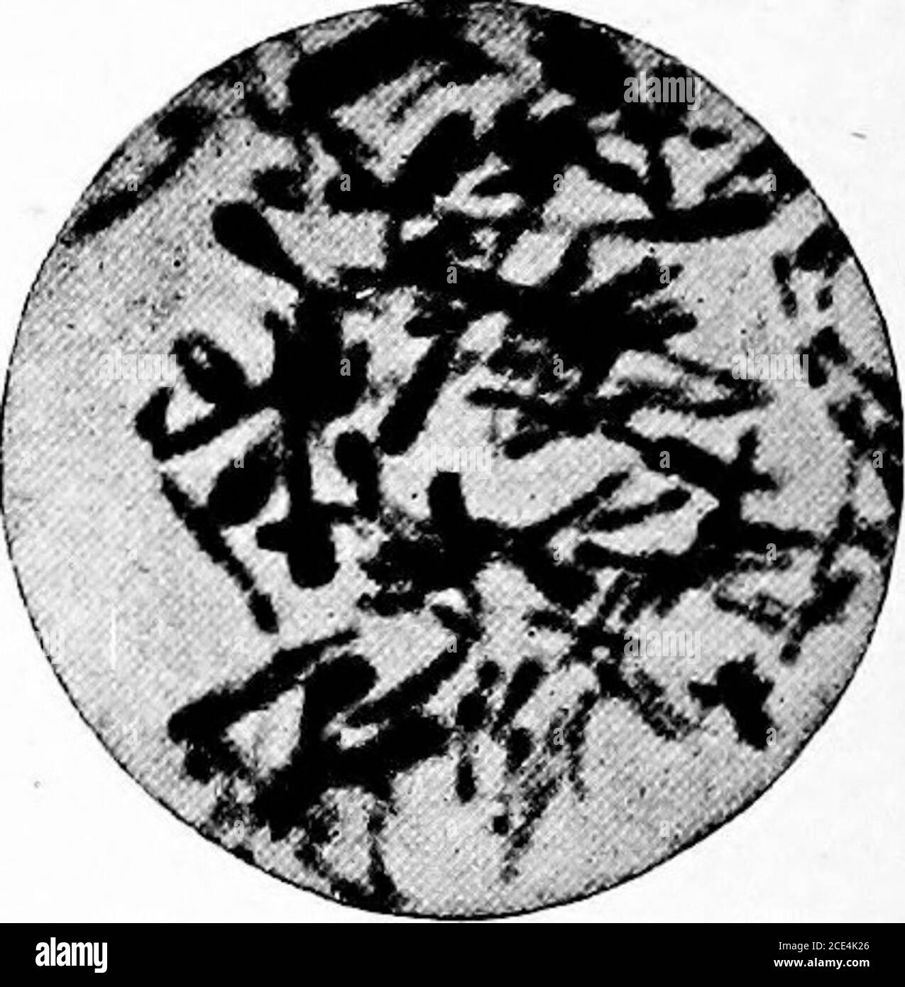 . microörganisms patogena; un manuale pratico per studenti, medici e operatori sanitari . Fig. 117.-B. agar coltura difterite. Bacilli di forma piccola e uniforme. X 1000 diametri. &gt;^%^^ m ^-«( Fig. 119.-B. difteriae. Quarantottesima coltura di agar. Molti segmenti; estremità lunghe, indiane-clubbed. Un anno sui media artigianali. X 1410 diametri. Fig. 118.-B. difterite. Quarantottesima coltura di agar. Spesse, indiane-clubbed aste e numero moderato di segmenti. Un anno sui culturemedia artificiali. X 1410 diametri. Foto Stock