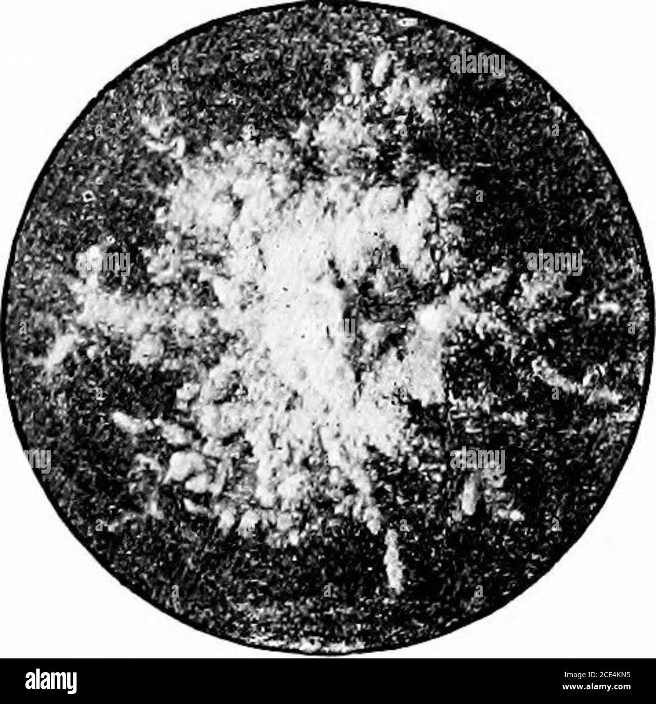 . microörganisms patogenica; un manuale pratico per studenti, medici e operatori sanitari. Marcata preferenza per il cuoio capelluto, ma nessuna parte della pelle è esente, e anche le mucose sono suscettibili di essere attaccate. Kaposi ha riportato un caso in cui un paziente affetto da favus universale è morto, con sintomi di grave irritazione gastro-intestinale, che è stato trovato dopo la morte per essere dovuto la presenza del fungo favus nello stomaco e nell'intestino. Fosterha riferito molti casi di favus e ringworm delle unghie in immigrants.on il cuoio capelluto appare prima come un minuscolo disco sulfiu-giallo o sc Foto Stock