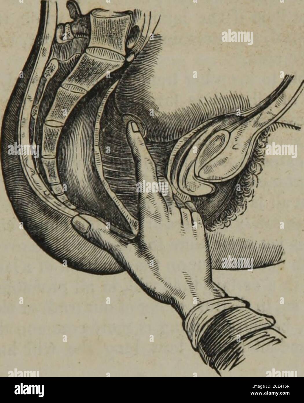 . Sulla teoria e la pratica dell'ostetricia . o rettificare una male-presentazione. Inoltre, l'assistente non dovrebbe mai lasciare il suo paziente per più di alcuni minuti, un-.ess ha accertato che tutto è giusto. La frequenza con cui deve essere ripetuta deve dipendere principalmente dalla velocità di avanzamento. Dur-ing la prima fase (a giudicare dal grido e la pelle fredda) è POCO LAVORO NATURALE. 219 necessario, se una volta che abbiamo accertato che tutto è giusto; ma durante la seconda fase, può essere ripetuto secondo la rapidità dell'anticipo, ogni quattro, sei, otto o dieci dolori; e quando una volta l'egli Foto Stock