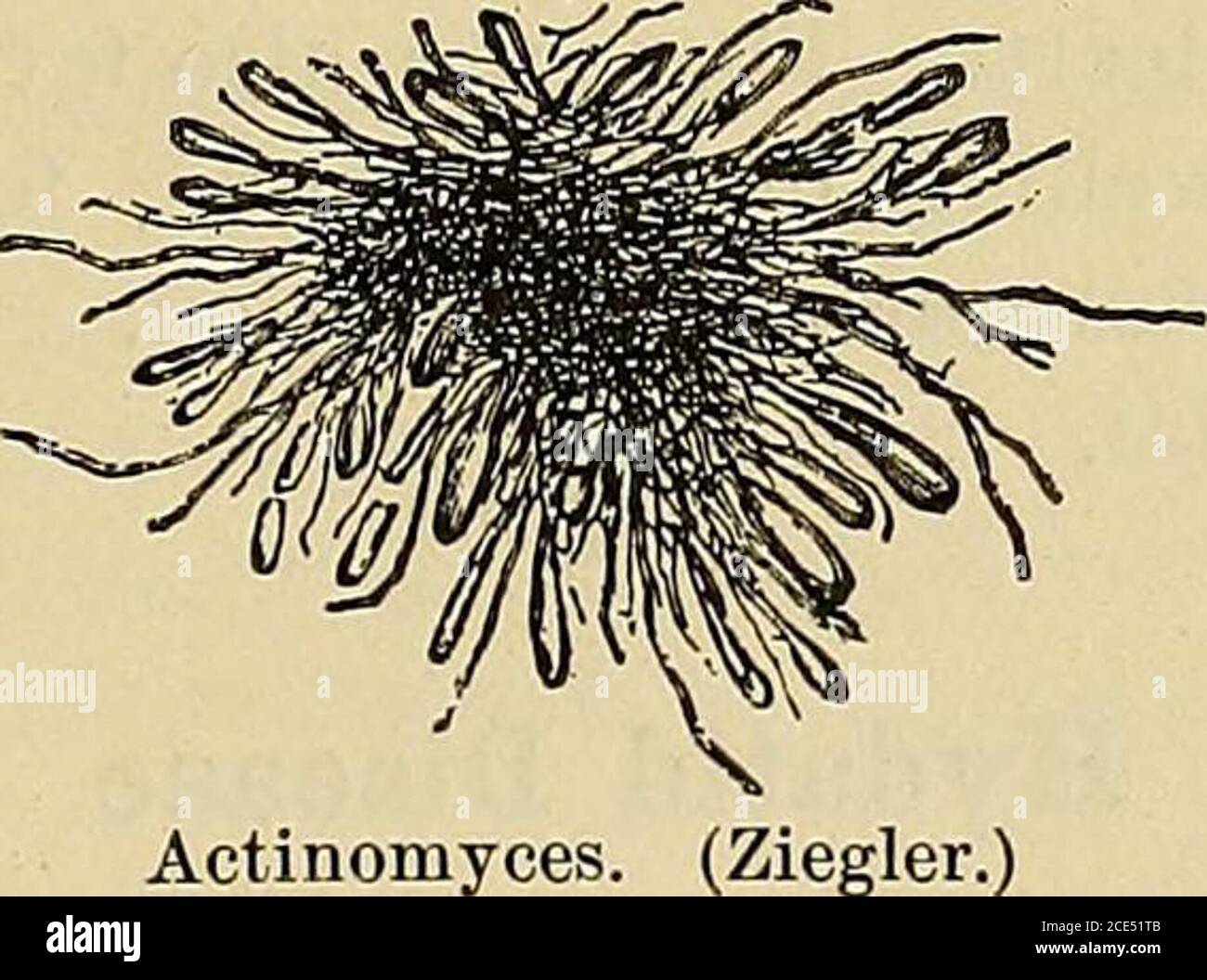 . Elementi essenziali della diagnosi. Organizzato sotto forma di domande e risposte preparate specialmente per gli studenti di medicina. Localtenerezza rilocale. I sintomi costituzionali sono quelli della settico-piemia: Malessere, mal di testa, depressione, febbre. Secondo il modo di introduzione del veleno, o la direzione in cui l'infezione si diffonde, altre manifestazioni appaiono. Alcune volte il tratto gastro-intestinale sembra sopportare il brunt della malattia e ci sono nausea, vomito, dolori addominali e diarrea, le feci sono sanguinose. La morte può avvenire a causa della spossatezza o della setticemia. In altri momenti, Foto Stock