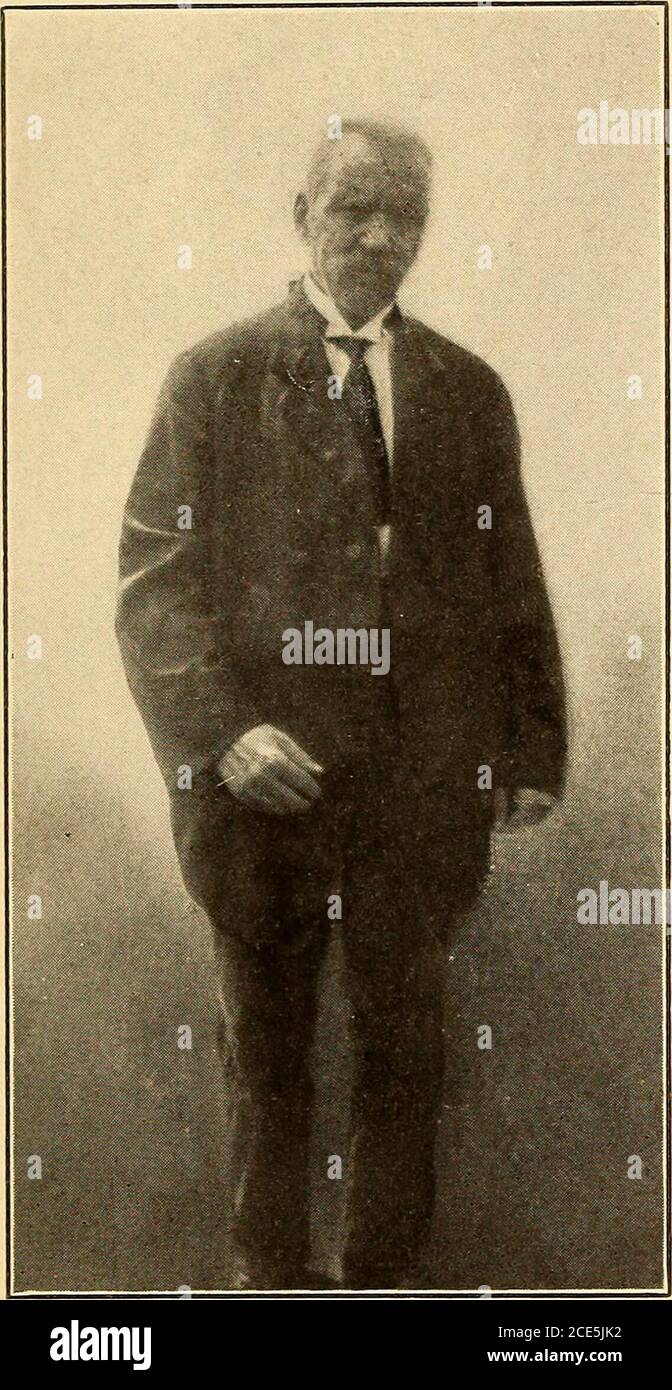 . Geriatria; le malattie della vecchiaia e il loro trattamento, compresa la vecchiaia fisiologica, l'assistenza domiciliare e istituzionale, e le relazioni medico-legali . Tremorgraph: Paralisi agitatori, mano sinistra. (Neustaedter, Med. Record, 17 luglio 1909.. Paralisi precoce agitans; caratteristica di AS-pect facciale. Atteggiamento non yetpronuncied. (Dr M. Neustaedterscase) PARALISI AGITANS 377 di un tumore, dobbiamo ricorrere a misure temporanee per diminuire la circolazione teerebrale. Le misure più efficaci per questo pur-posa sono piede caldo o bagni di sitz. L'iperemia locale in altre parti del corpo può essere prodotta dalla senape, turp Foto Stock