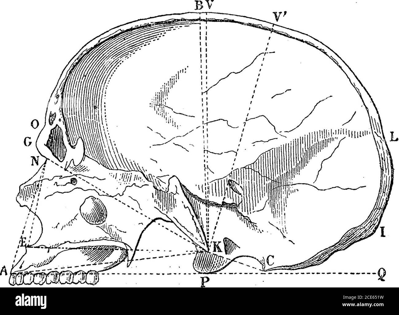 . Antropologia . Lapps dai musei scandinavi (Hamy) Indice verticale TJie. 71-37 71-7572-2276-0076-6077*4577-4078-0081-8782-9083-0084-0684-93 l'indice verticale, o indice di altezza, è meno importante. Essa presenta la forma del cranio secondo una sezione antero-posteriore, che divide l'ovoide cranico in due metà laterali, nello stesso percorso dell'indice cefalico, o l'indice di ampiezza dà la forma di CHAP, ii.] INDICE VERTICALE. 243 il cranio come è mostrato dalla norma verticalis di Blumenbach. È la relazione tra il diametro verticale e l'anteroposteriore massimo sopra menzionato Foto Stock