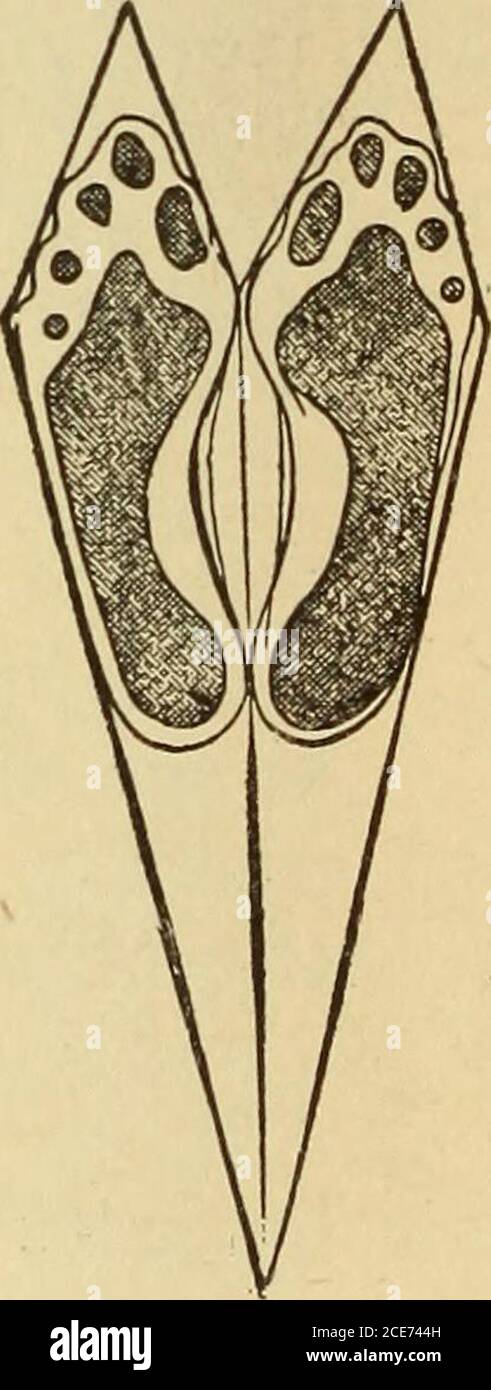 . Dr. Evans' come mantenere bene; . Fig. 266.-UNA punta dannosa e di forma stretta. COPRENDO I PIEDI se l'alloggio-casa infamed è un tramp o un operaio stagionale, ifhe sia saggio che si manterrà equipaggiato con calze calde. Eppure Flynt COPERTURA DEI PIEDI 767 Foto Stock