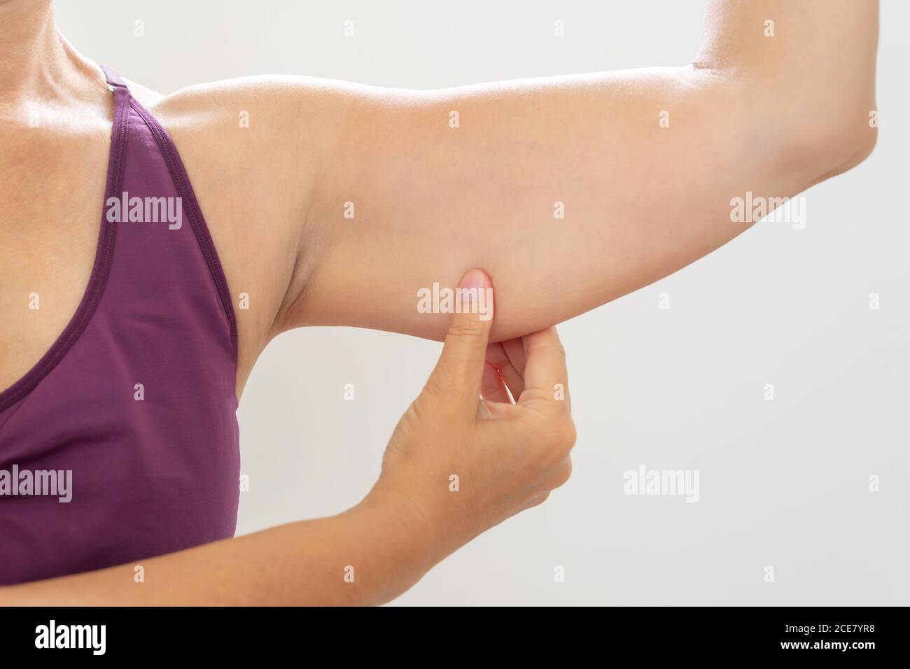 Donna matura pizzicando braccio flabby, cura del corpo e concetto di fitness Foto Stock
