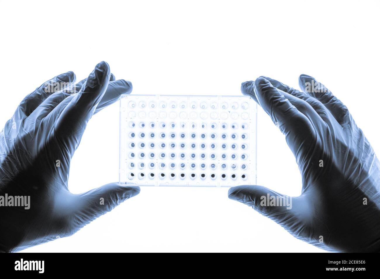 I campioni di DNA vengono caricati su una piastra a 96 pozzetti per l'analisi PCR Foto Stock