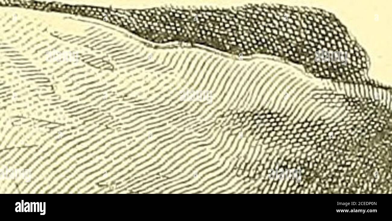 . L'anatomia e il trattamento chirurgico di ernia. Ione. La ferita viene chiusa con drenaggio. L'apertura interna e la parete posteriore sono di nuova forma, l'anello esterno si restringe. In questo modo si ripristina la posizione obliqua normale dell'avanale. La parete posteriore, essendo composta da musclee aponeurosi, è permanente, e non scomparirà come il tappo cicatriziale inWoods operazione. Negli autori 102 casi, 95 sono stati riduttibili e 7 sono stati strangu-lated; nel 98 l'ernia era completamente obliqua, e in 4 diretto completo. ProfessorBassini, in un articolo recentemente pubblicato su Langenbecks Archivia, registra 216 casi Foto Stock