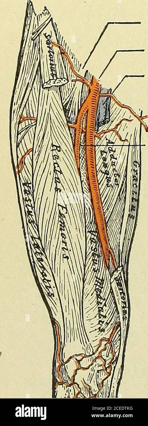 . Testo-libro di anatomia e fisiologia per gli infermieri. Di thestorius, il bordo mediale dal longus dell'adduttore e l'apice dall'attraversamento di questi due muscoli sul lato mediale della coscia intorno al centro. Le strutture più importanti del triangolo sono l'arteria femorale e la vena affiancate, in una linea che va dalla metà DELL'ANATOMIA del 302 E DALLA FISIOLOGIA PER GLI INFERMIERI. Base all'apice. Il nervo femorale e le diramazioni si trovano sul lato laterale dell'arteria. Ordine delle strutture come passano sotto il legamento inguinale: V-ein, A-rtery, N-erve, la vena essendo medialward. Canale dei cacciatori (Addotto Foto Stock