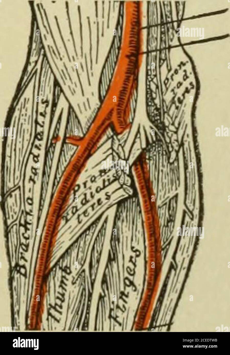 . Testo-libro di anatomia e fisiologia per gli infermieri. Fig. 208.-spazio ascellare. Ascella distesa dalla divisione della parete anteriore. Fig. 209.-spazio ante-cubitale. Il muscolo pronatore diviso per mostrare l'arteria ulnare. Triangolo di Scarpas (Trigonum Femorale). Questo triangolo si trova sulla parte anteriore della coscia. La base è attraversata dal legamento inguinale, dal bordo laterale dalla metà superiore del thestorius, dal bordo mediale dal longus dell'adduttore e dall'apice dall'attraversamento di questi due muscoli sul lato mediale della coscia intorno al centro. Le strutture più importanti del triangolo sono l'arteria femorale e la vena l. Foto Stock