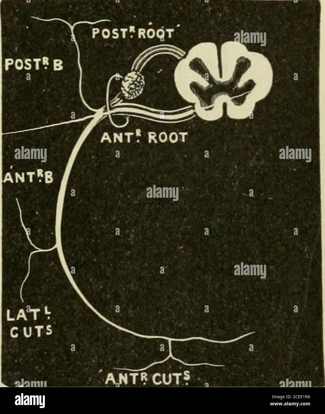 . Testo-libro di anatomia e fisiologia per gli infermieri. Fig. 172.-Dorsal SunrACE di LeftHand (Morris). Fig. 173- -un Nerve intercostale (Holden). Punti di interesse.- il nervo ulnare nel braccio è con l'arteria pro-funda inferiore e passa dietro l'epicondilio mediale; può essere facilmente sentito nel solco dietro l'epicondilio, dove la pressione provoca una sensazione di dolore e formicolio fino al dito piccolo. Nell'avambraccio si trova sul lato ulnare dell'arteria ulnare e passano davanti al polso. Il nervo mediano, nel braccio, è con il muscolo bicipite e l'arteria brachiale, e passano davanti o Foto Stock