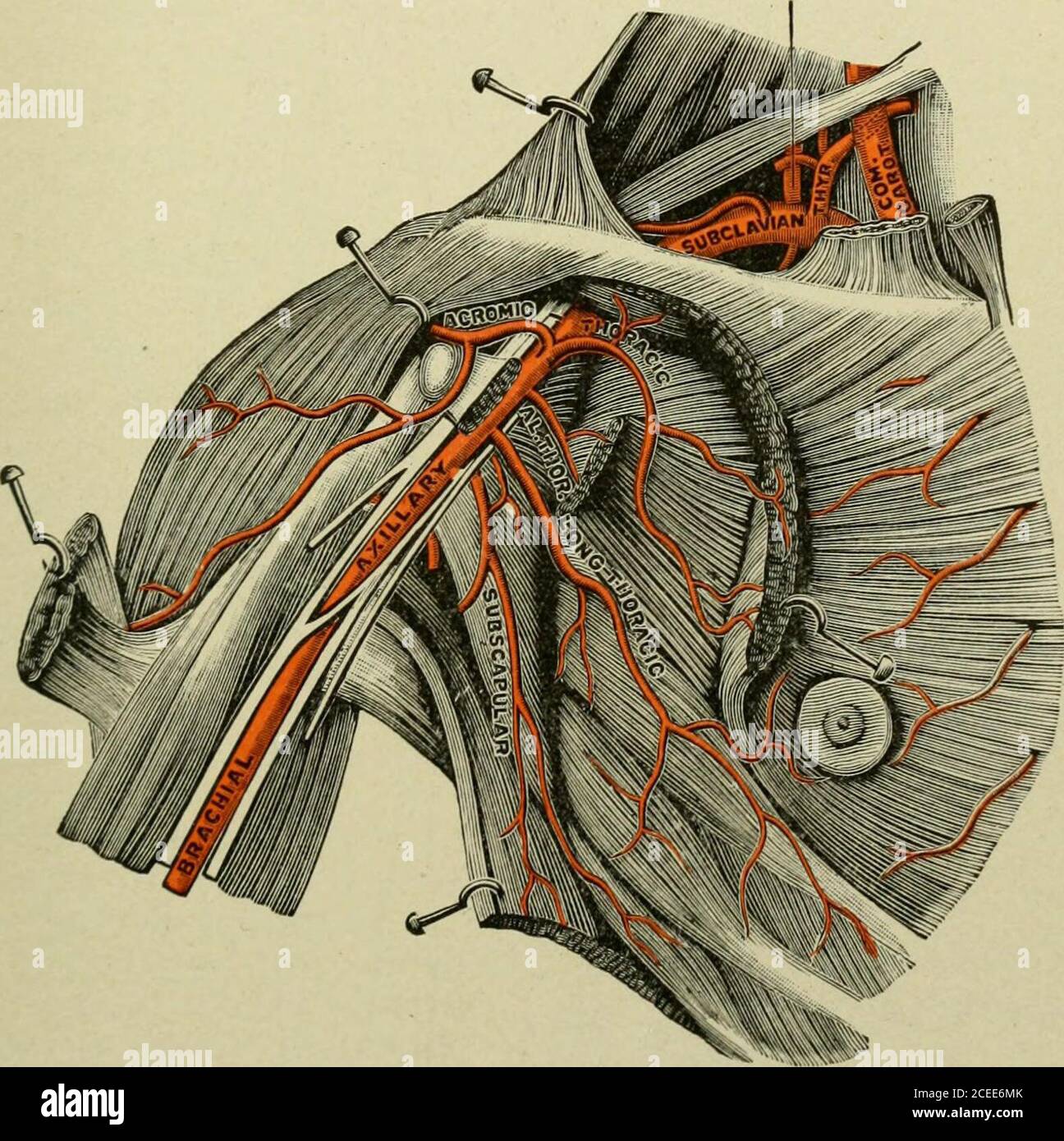 . Libro-testo di anatomia e fisiologia per gli infermieri. Carotide Veingiugulare interna Veincolavia muscolo anteriore Scaleno - sterno i rami perforanti/ j (fornendo ghiandola mam-mary) superiore epigastrico, runningdown da epigastrico inferiore mammario interno, runningup da iliaco esterno Fig. 122.-che mostra l'arteria succlavia e due delle sue diramazioni (asse tiroideo e mammia interna) (Morris). Le arterie principali dell'estremità superiore. L'arteria succlavia (Fig. 122) passa sopra la prima banda sotto la clavicola (quindi sottoclavia) all'ascella, orascella. Il plesso brachiale giace Foto Stock