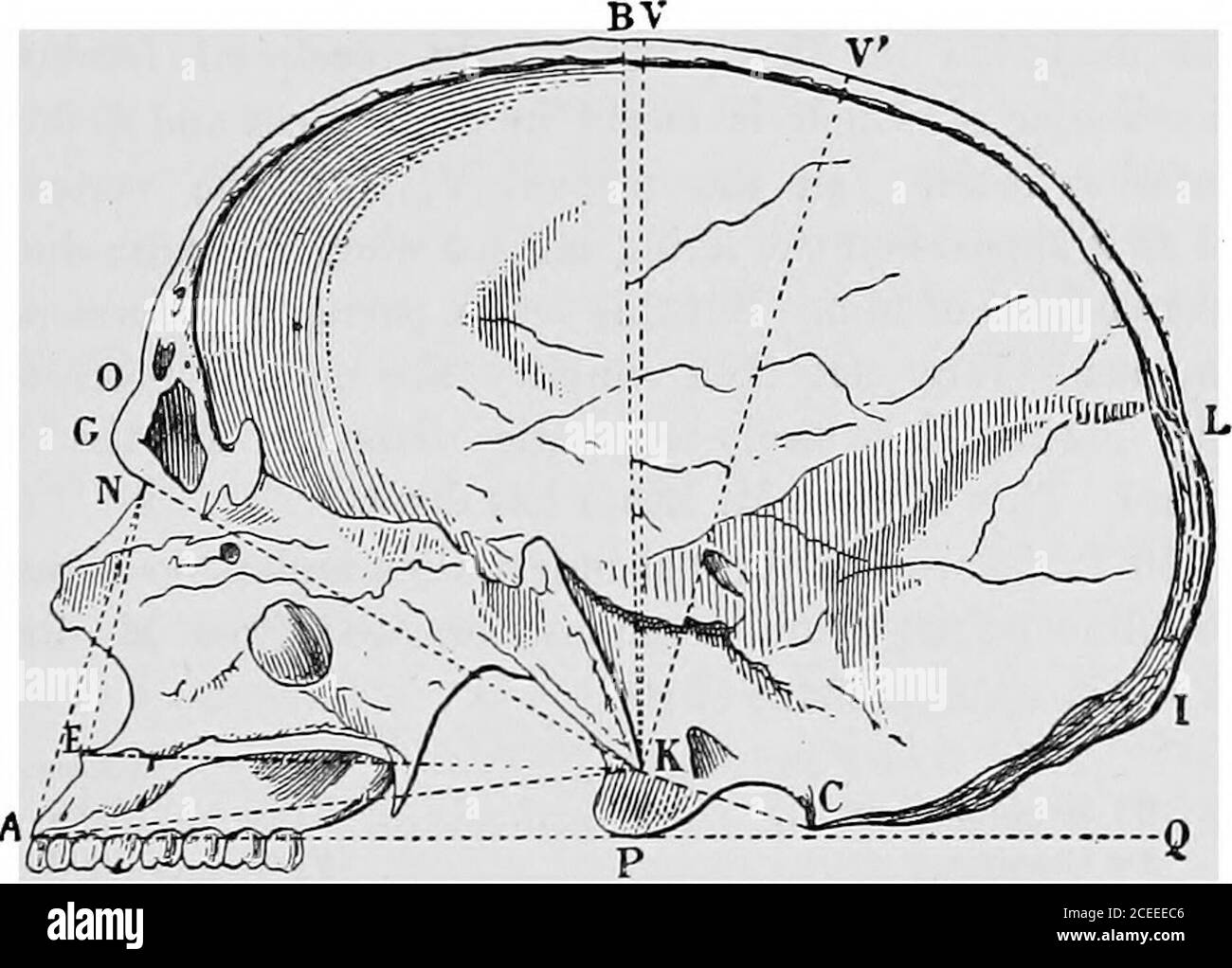 . Antropologia. 0 Roumanans (Hovelacque) ... ... ... 84-06 30 Lapps dai musei scandinavi (Hamy) ... 84-93 Indice verticale. L'indice verticale, o iudex di altezza, è meno importante. Esso dà la forma del cranio secondo una sezione antero-posteriore, che divide l'ovoide cranico iato due metà laterali, sia come lo iudex cefalico, o l'indice di larghezza dà la forma di CHAP, ii.] indice veeticaij. 243 il cranio come è mostrato dalla norma verticaKs di Blumenhach. È la relazione tra il diametro verticale e il diametro antero-posteriore massimo prima del menzionedmassimo Foto Stock