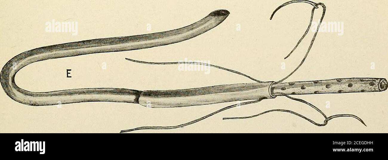 . Un nuovo manuale di chirurgia, civile e militare. A, B, Trocar per aspirare il fluido dalla camera d'aria. C, doppio misurino per la rimozione di pietre da gall. D, pinzette per la rimozione di pietre di gallone. E, tubo di gomma utilizzato per il capello comune, ad eccezione della pelle, per la quale viene utilizzato il capello. Ora legando le suture del wormgut di seta la chiusura della ferita è completata. 4. Un po' di tessuto di gomma è ora imbottito fino alla vescica di gallina, tra i bordi della parete addominale e il tampone di garza, per facilitare la rimoval, circa il quinto giorno, quando il tubo di drenaggio di gomma è inserito nella vescica di gallina Foto Stock