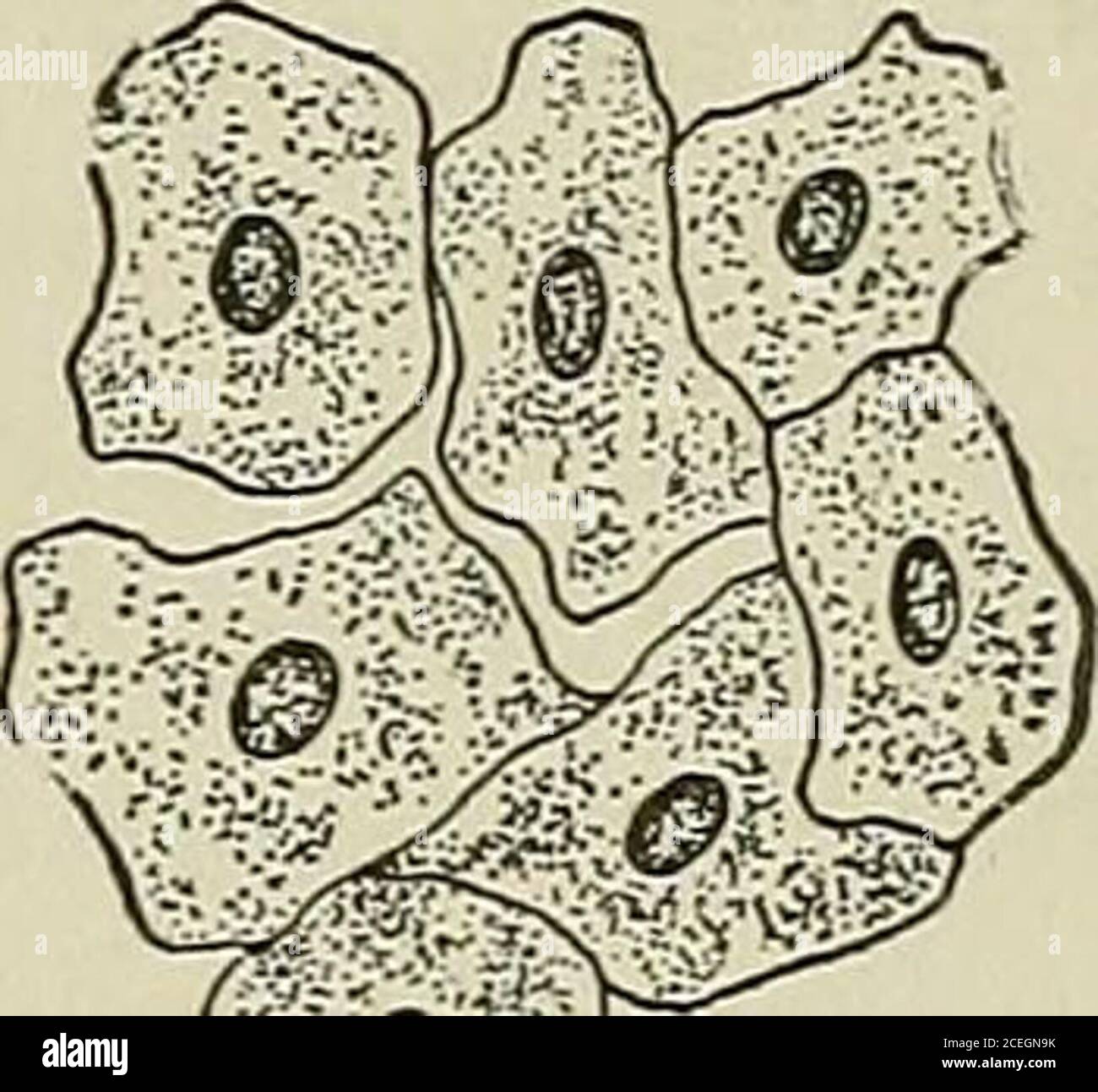 . Testo-libro di istologia normale: Compreso un resoconto dello sviluppo dei tessuti e degli organi. Diagramma di una tipica membrana mucosa: E, epitelio di superficie libera con-tinuing nella depressionea ghiandolare per diventare le cellule secernenti; h, membrana base-mento che separa epiteliumand stroma del tessuto connettivo; s,s,tessuto fibroelastico della tunica propria; V, vasi sanguigni che formano la rete di lavoro sotto l'epitelio e intorno alla ghiandola. MEMBRANE MUCOSE E GHIANDOLE. 137 Fig. 162.. Le membrane mucose possono essere invase ad una maggiore o meno sgrassata da cellule linfoidi, come in molte località nel tr digestivo Foto Stock