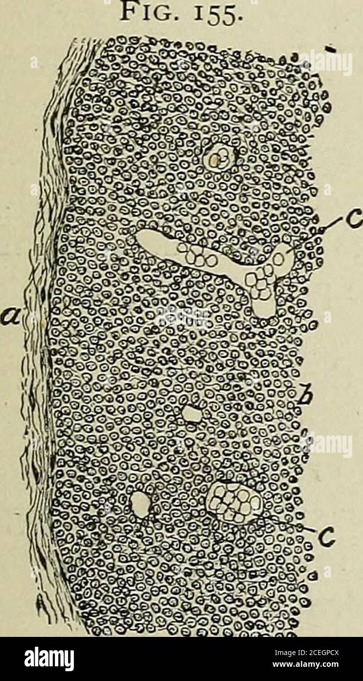 . Testo-libro di istologia normale: Compreso un resoconto dello sviluppo dei tessuti e degli organi. Sezione del corpo del timo umano, che mostra offollicoli di disposizione generale: A, tessuto fibroso che avvolge il tessuto linfoide e sendingsepta (of) tra i follicoli (b); d, tessuto interfoUicolare, contenente vasi sanguigni (<:). Impaccati con cellule molto più che con quella che occupa il centro, o medulla, in conseguenza della quale la variazione del medulla è più piccola della corteccia più densa. Sparso attraverso i follicoli Fig. 156.. Porzione della periferia di uno dei folli-cles dei foregoi Foto Stock