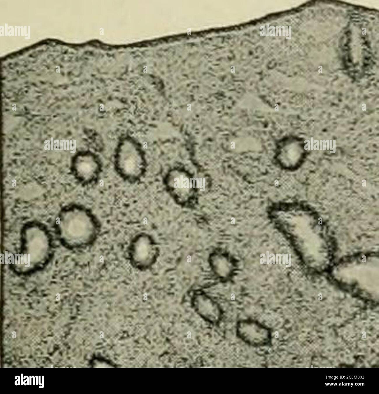 . Ostetricia per infermieri. Mestruazione ted bv. Mestruazione Fnter-mestruale mestruale post-znenstrual 1 12 i^UI kl7l8l9|a|u|l3|l|»1S1fc 17 lgf^Uo|ai|33b3|a4-|35|jp7afe|Fig. 21.-curva mestruale. (Dopo Munge e Opitz). Nonostante il fatto che una donna possa essere cosciente di una differenza nelle ersensibilità per soltanto alcuni giorni vicino alla tiga, è generalmente riconoscizedche durante le quattro settimane intere ci è in corso un cambiamento definito del ciccleof. Questa curva è rappresentata come in Fig. 21, la cresta del thecurve che indica il punto di copertura dei processi di vita e il theebb di valle. Ieniperat Foto Stock