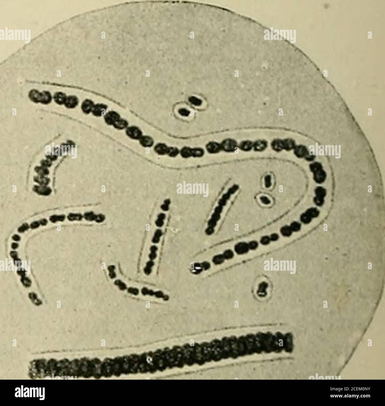 . La batteriologia dell'occhio. Erosa resistenza all'infezione, e in questi casi wefind pneumococco infezione assumendo la forma di un semplice infiltrato, senza bordo progressivo anydense. 304 BATTERIOLOGIA DELL'OCCHIO Augstein conferma questo, e afferma che un ulco serpen con Pneumococchi è molto raro nel tracoma, anche nei casi con dacryocystite, anche se in questi difetti patientsepieliali, sia traumatici che spontanei, si verificano frequentemente. Augsteinconsidera questo come una prova che il trachoma, o meglio il suo agente causale, deve avere un directagonismo al Pneumococococococococeis. Il suo punto di vista non è basato Foto Stock