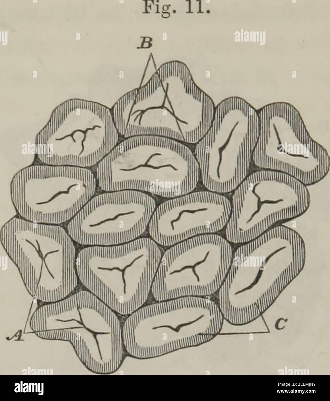 . Su malattie del fegato onsequence,insolitamente pallido. Di nuovo, quando, dalla ritenzione della materia biliare, le cellule nelle porzioni di argina hanno una colorazione gialla, accade spesso che mentre i centri dei lobuli sono profondamente iniettati, e sono consequentiledi un rosso profondo, le porzioni marginali, o parti di essi, sono quitevuote di sangue, ed hanno il colore giallo che è dovuto ai soli cells. Una sezione del fegato presenta, di conseguenza, quel contrasto stringenuante di colori che suggerivano il termine fegato di noce moscata. Accade occasionalmente, tuttavia, che il portale vene, e thecapillaries immediatamente Foto Stock