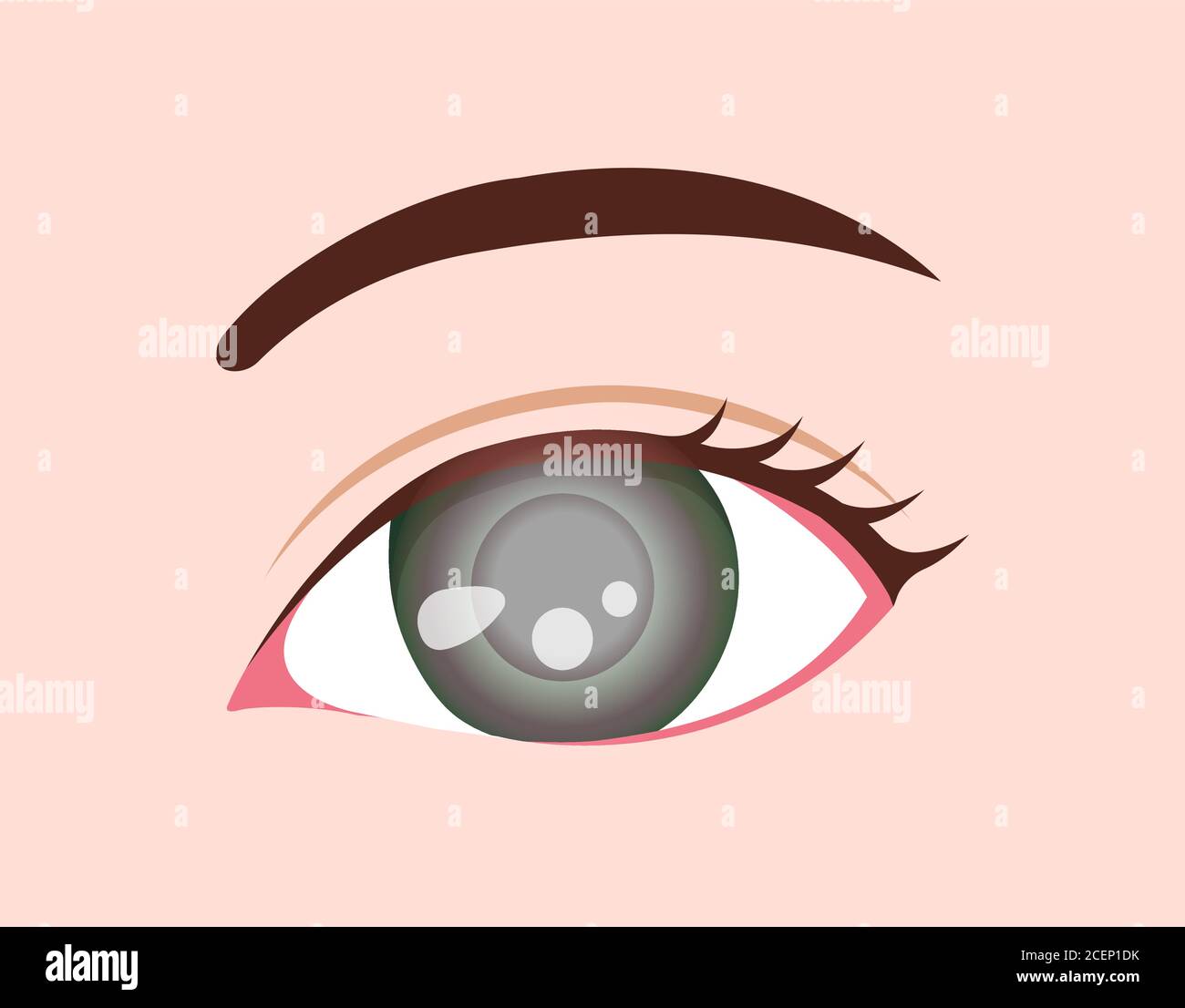 Illustrazione vettoriale delle malattie oculari / glaucoma Illustrazione Vettoriale