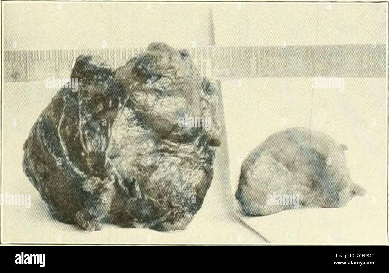 . Contributi del Dipartimento di Neurologia e del laboratorio di Neuropatologia (ristampe); l'area deve essere rimasta intatta, oppure la corrispondente area dell'opposto deve aver assunto una funzione viearia. Tali spiegazioni non hanno soddisfatto tutti gli investigatori; Von Moiiakow ha avanzato la teoria di bis diaschisis e insiste tliat non dobbiamo identificare l'offunzione di localizzazione con la localizzazione dei sintomi. La localizzazione dei sintomi focali è una reazione complicata del sistema nervoso non-jured all'insulto corticale locale; mentre la localizzazione della funzione dipende dai teacti Foto Stock