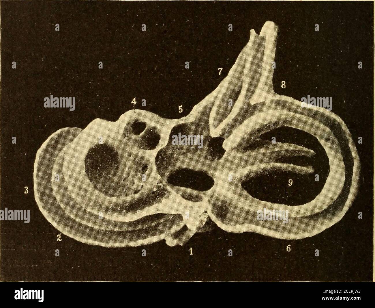 . Malattie dell'orecchio; un libro di testo per i professionisti e gli studenti di medicina. Lato di Osite e con l'area corticale ofaudition nel cervello. 4 34 ANATOMIA E FISIOLOGIA DELL'ORECCHIO. Per comodità di descrizione, l'andamento del nervo uditoristico sarà seguito dall'organo terminale specializzato fondante il labirinto, verso l'interno verso la sua origine, piuttosto che nella direzione opposta, che sarebbe più strettamente corretto dal punto di vista anatomico dell'uomo. L'orecchio interno comprende il labirinto osseo e membra-noso, il primo essendo una serie di camere di comunicazione tunnellate nel porto di petrous Foto Stock