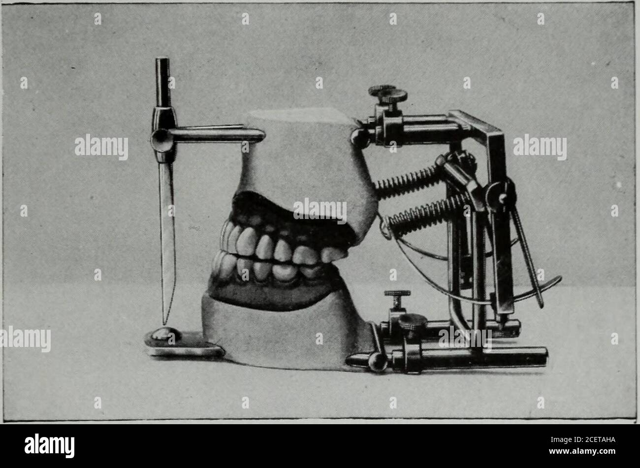 . Il cosmo dentale. Full dentiera. Percorso del condilo con un'inclinazione di 35 gradi. Tutti i denti anteriori dodiciveupper seguono una linea retta (piano occlusale); i secondolari sono posti più in alto, formando un piano di compensazione. Gli archi sono in stato di riposo (occlusione). 19), sia movimenti di inprotrusione che laterali, il condimento degli incisori e dei molari destro e sinistro è costante; è sufficiente cambiare il percorso condilo dell'articolatore per vedere i difetti che risultano nei contatti degli archi. Forinstance, se diamo al tracciato del condilo un AMOEDO.- OCCLUSIONE AN Foto Stock