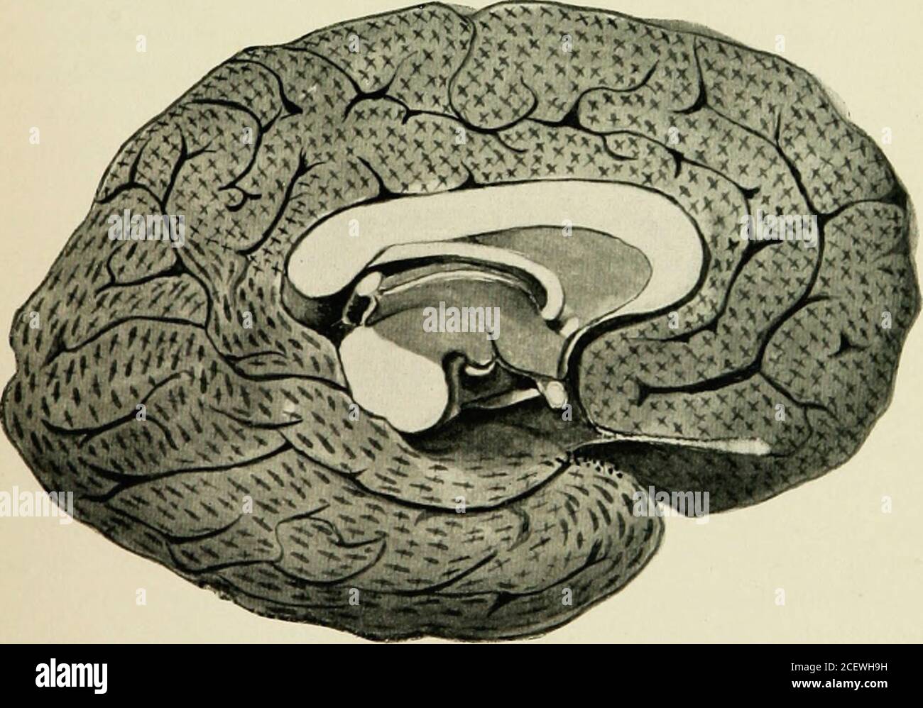 . Un trattato sulle malattie mentali. Fig. Diagramma della distribuzione della circolazione corticale. Aspetto esterno di un emisfero. + Area di distribuzione dell'arteria cerebrale anteriore Area di distribuzione dell'arteria cerebrale media. -+- Area di distribuzione dell'arteria posteriorcerebrale.. JIGi 3. Diagramma della distribuzione della circolazione corticale. Aspetto interno di un emisfero. + Area di distribuzione dell'arteria cerebrale anteriore Area di distribuzione dell'arteria cerebrale media. ?+- Area di distribuzione dell'arteria posteriore-cerebrale. 8 UN TRATTATO SULLE ARTERIE DELLE MALATTIE MENTALI Foto Stock