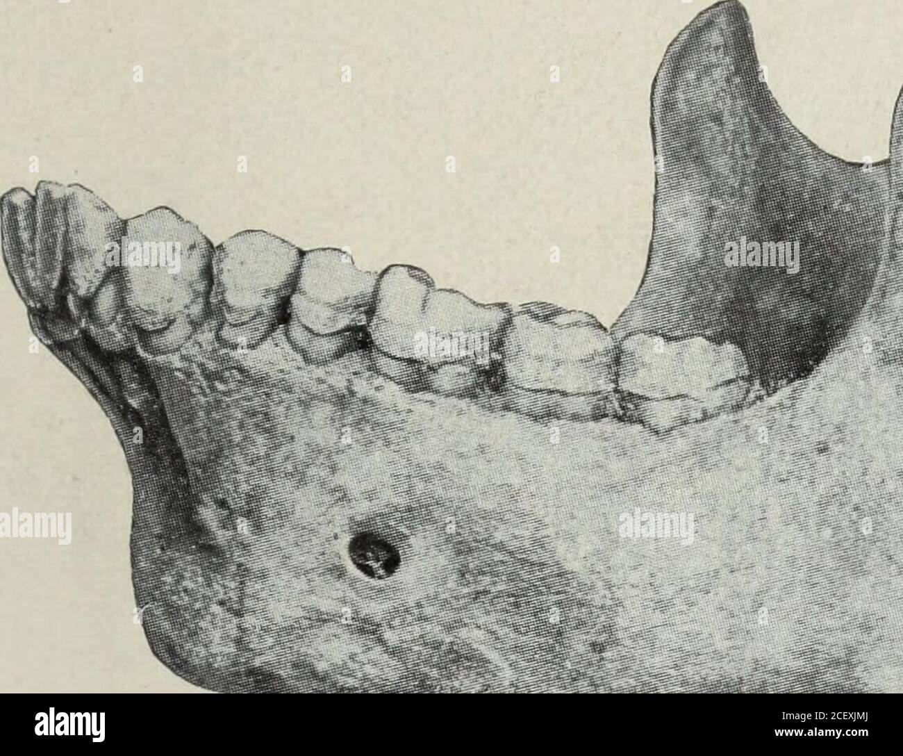 . Il cosmo dentale. Cranio di bulldog. Mostra un maiale che ha vinto il primo premio come lo scopo espresso di corteggiare la lepre, miglior porco bianco ad un Royal Agricultural in cui nessun altro cane può competere con Show in Inghilterra; Fig. 2 è un'immagine di lui. I pedigree di questi cani sono un poro che ha vinto il primo premio ad uno spettacolo tenuto più attentamente in Inghilterra che l'ASSOCIAZIONE NAZIONALE DENTALE. 335 registrazioni delle vendite di terreni. Questo dogis ha bred per resistenza e lavoro veloce, senza attributi rapidi-girando e con jawsthat può prendere la presa del suo gioco, mentre hecan respira attraverso la bocca al momento theame. Do n Foto Stock