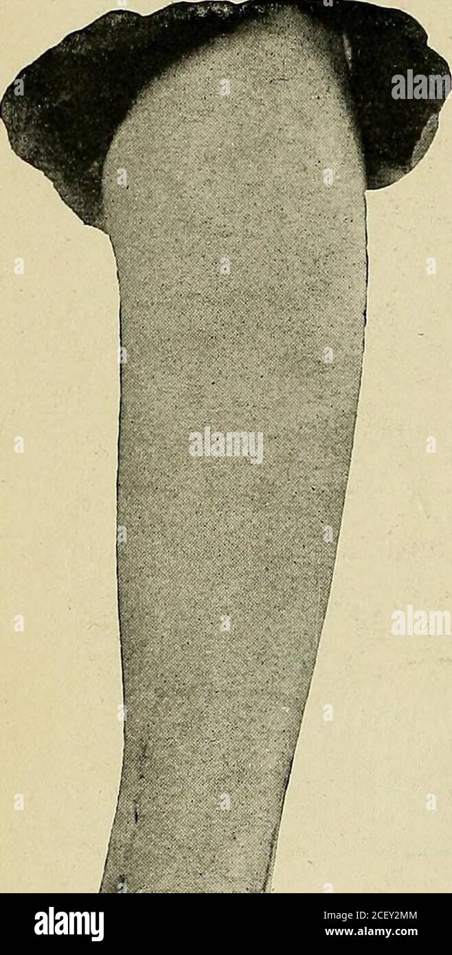 . Un trattato pratico su fratture e dislocazioni. Ter applicarne uno nuovo dopo pochi giorni. Nella frattura composta con una piccola infezione della ferita può essere generalmente evitata con le misure usuali, e un buon risultato ottenuto. Se la ferita è o deve diventare infetta drenaggio deve essere fatto su boshside, e il piede tenuto quadrato sulla gamba che la sua utilità può beas grande possibile dopo il probabile risultato di anchilosi. Nei rari casi di rotazione del malleolo interno o di intctpositionedi una striscia di periosteo, la condizione deve essere corretta mediante incisione aperta. In vecchie fratture con Foto Stock