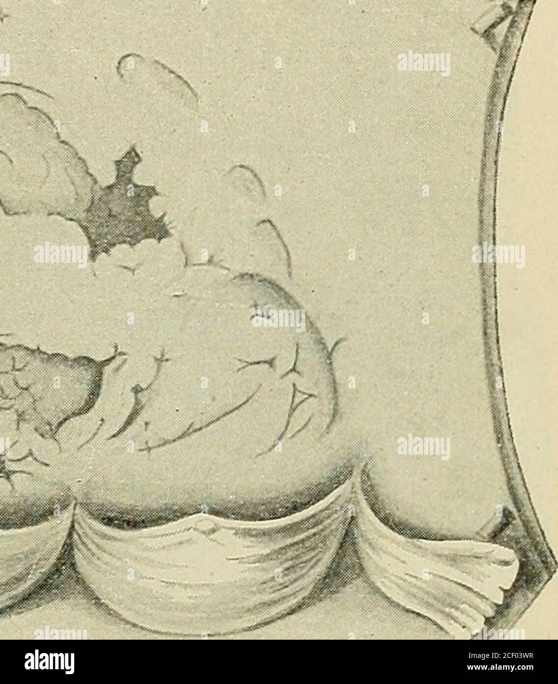 . Lehrbuch der speziellen patologischen Anatomie für studierende und Ärzte. (Mesaortite). Eiitzündungren der Arterien. 73 kleinen Abschnitt betrift, sind ganz besonders charakteristisch und erstrecht, wenn sie Individuen in jugendlichem Alter (20er, 30er Jahre)betriffen, mit gewöhnlicher Arteriosklergar nicht zu verwechseln(Doehle, Puppe, Hose), verf. Aus zahlreichen eigenen Beobachtungen führe ich nur als einige Beispiele an:den auf S. 41 erwähnten Fall eines 35jähr. Manne, dann den einer 23jähr. Kellnerinmit Herzguramen, wo nur der Anfangsteil der Aorta schwielig-grubig umge Foto Stock