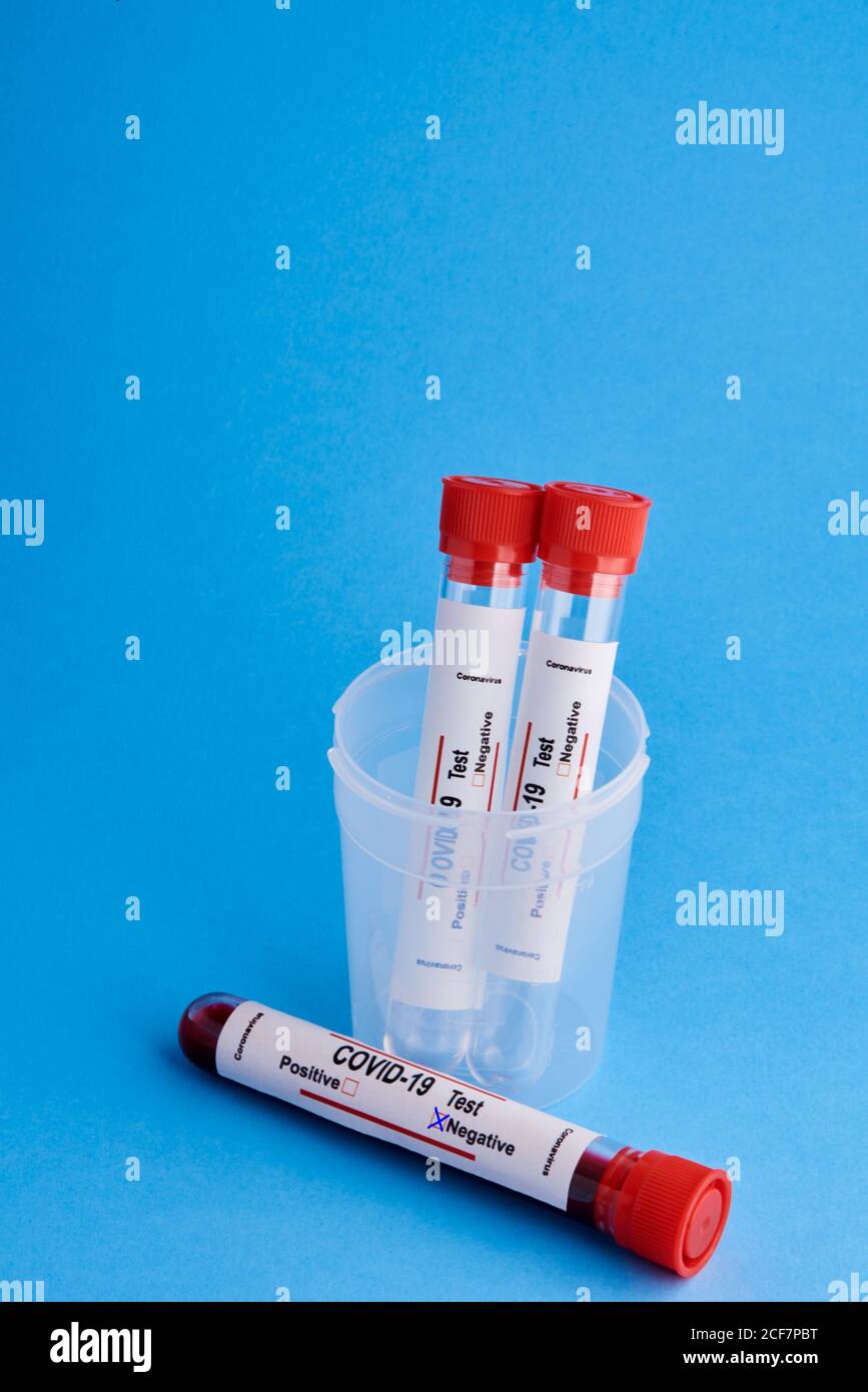 Dalla parte superiore, la provetta per analisi con i campioni di sangue nella provetta coppa in plastica per test diagnostico del coronavirus con contrassegno negativo su sfondo blu Foto Stock