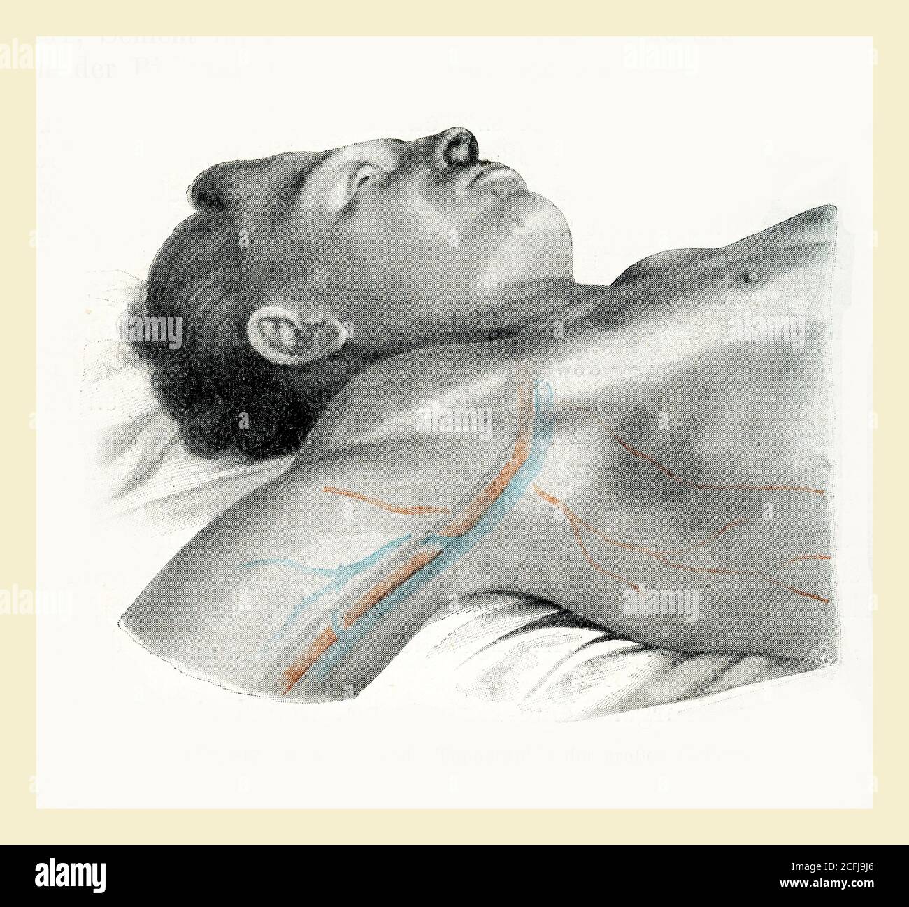 Sanità e medicina: Topografia grandi vasi Foto Stock