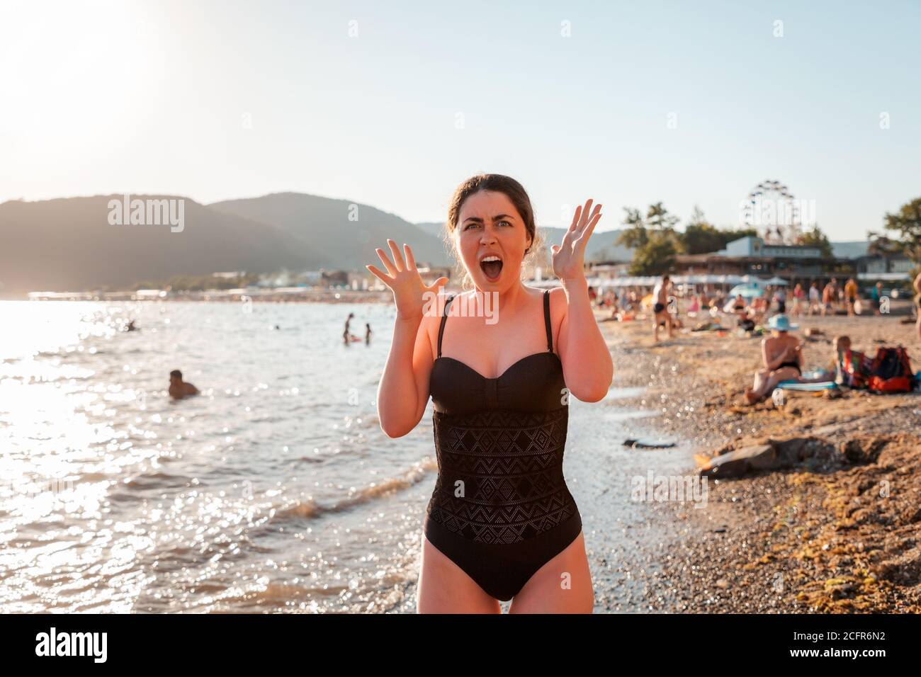 Una donna in costume da bagno urla di scottature. Arrossamento sulla pelle del viso e del corpo. Sullo sfondo, la spiaggia e il mare. Il concetto di pro Foto Stock