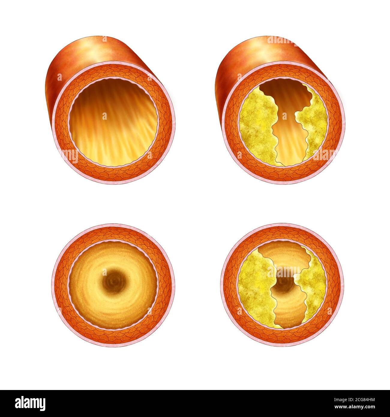 illustrazione anatomica della sezione trasversale vascolare Foto Stock