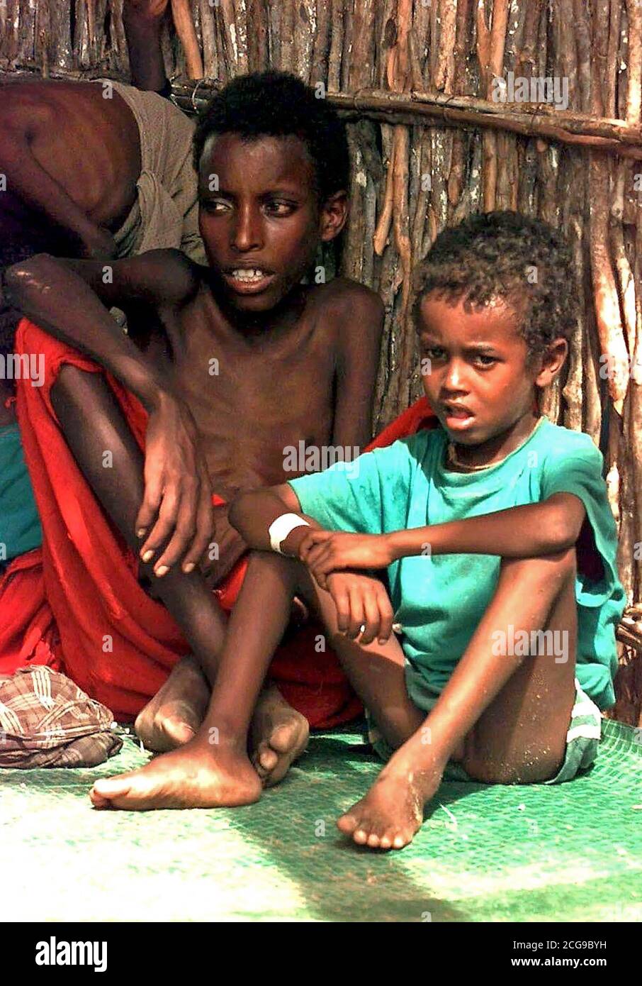 1992 - dritto, inquadratura ravvicinata dei due somali bambini seduti su un tappeto verde in bamboo hut. I bambini sono molto emaciato cercando. Foto Stock