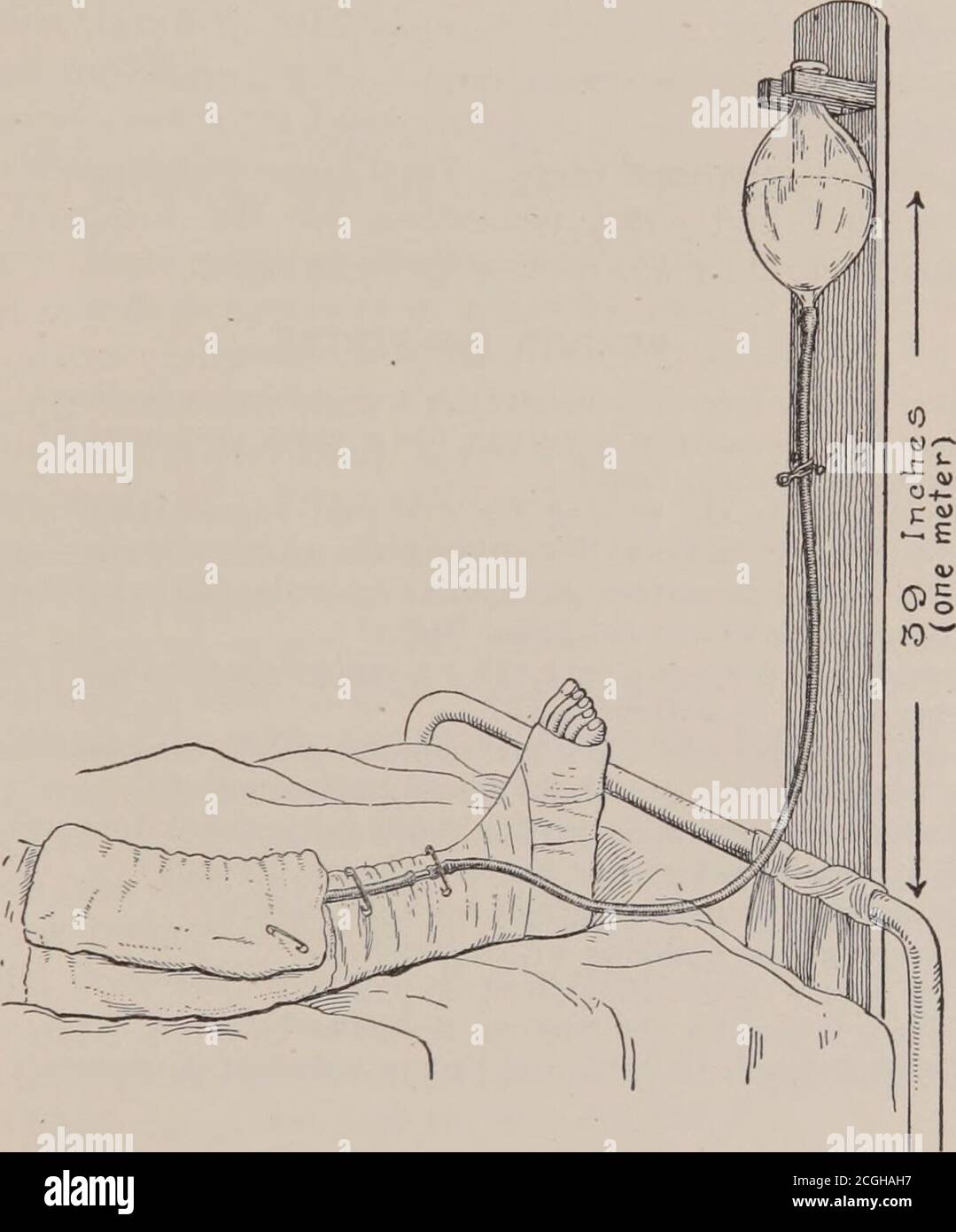 . Primo anno di cura : un testo-libro per gli allievi durante il loro primo anno di lavoro ospedaliero . Fig. 33.-il modo giusto per gestire un bacino.-(Athens Home Nurses Hand-book of Practical Nursing.) Non appena diventano opachi, che è molto rapidamente, askthat loro essere resharpened. Spiegare al paziente che la rimozione dei punti non è dolorosa, come molti personshave una paura inragionata del processo. I punti nel perineum sono circa quelli che l'occasione anypain su essere rimosso. Il trattamento Carrel-Dakin delle ferite - per infettidwounds il metodo Carrel-Dakin è ora la forma accettata DI MEDICAZIONI 151 DEL REPARTO Foto Stock