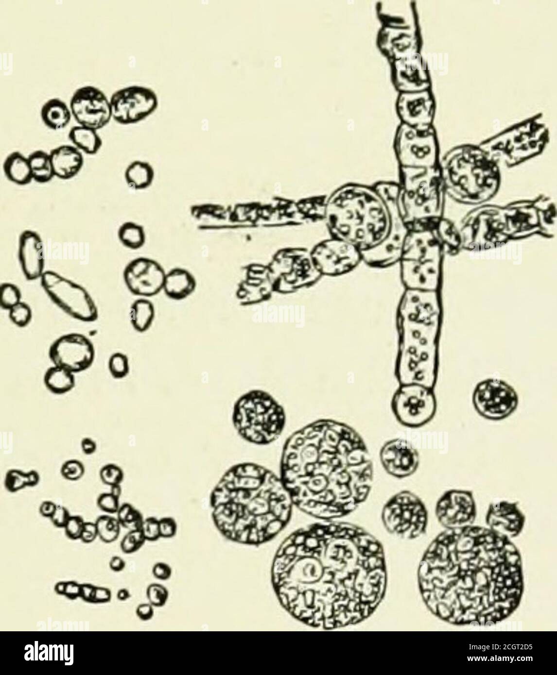 . L'esaminatore dell'assicurazione sulla vita. Un trattato pratico sugli esami medici per l'assicurazione sulla vita . Il fungo dello zucchero da diabeticurina, x 240. (Beale.) Esame microscopico dei depositi urinari. Test. INGREDIENTI. Colore. Calore. Acido idroclo-rico. NitricAcid. Altri test. Nitrato di ammoniaca.. Bianco 01 rosa. Bianco. Bianco. Rosso. Nuvoloso. Rosso.giallo.Bianco. Solubile.insolubile.insolubile.insolubile. Insolubile. Insolubile.insolubile.insolubile. Solubile.solubile.solubile.insolubile. Insolubile. Insolubile.insolubile.insolubile. Solubile.solubile.solubile.solubile.solubile. Insolubile. Insolubile.insolubile.insolubile. Precipitare Foto Stock