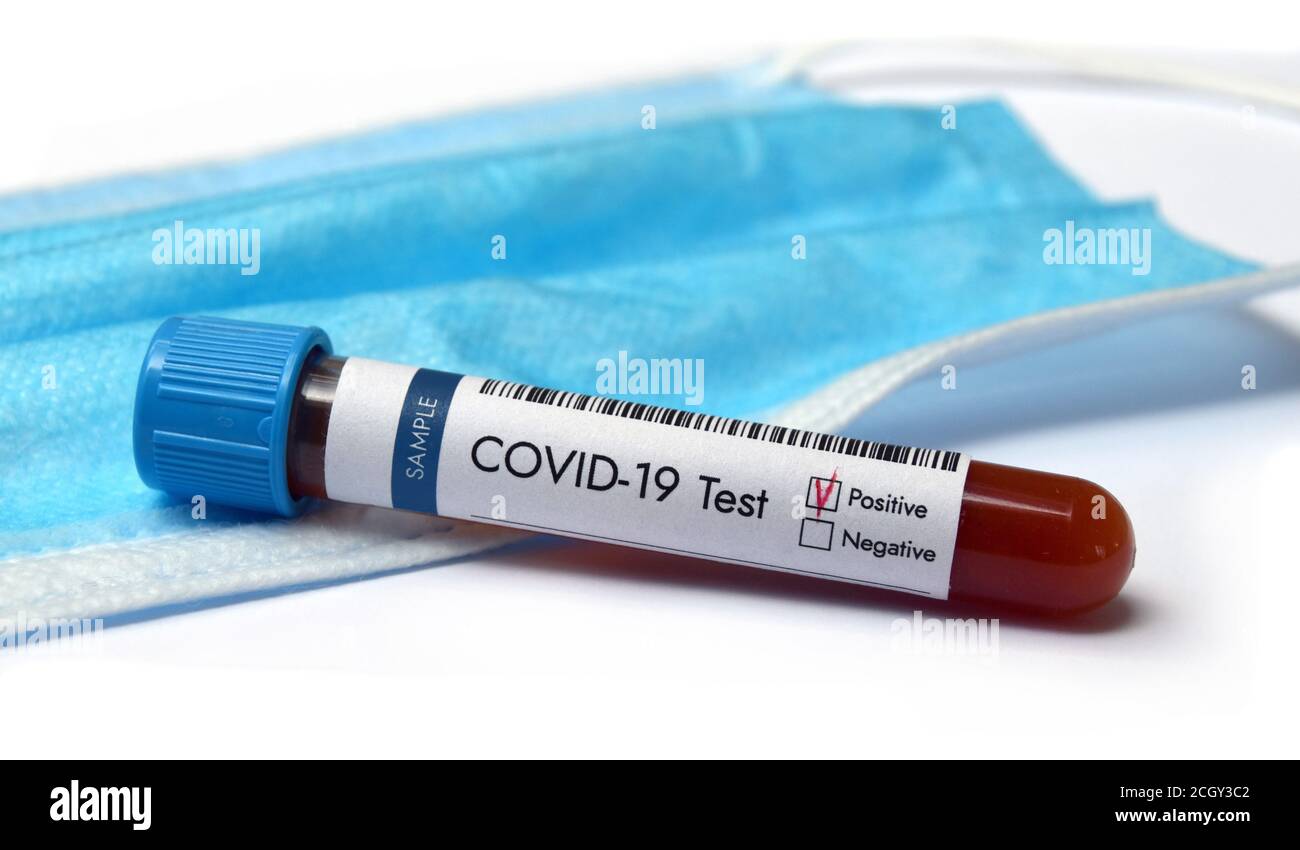 Risultato positivo del campione di sangue di analisi del coronavirus. Con maschera facciale nel sfondo Foto Stock