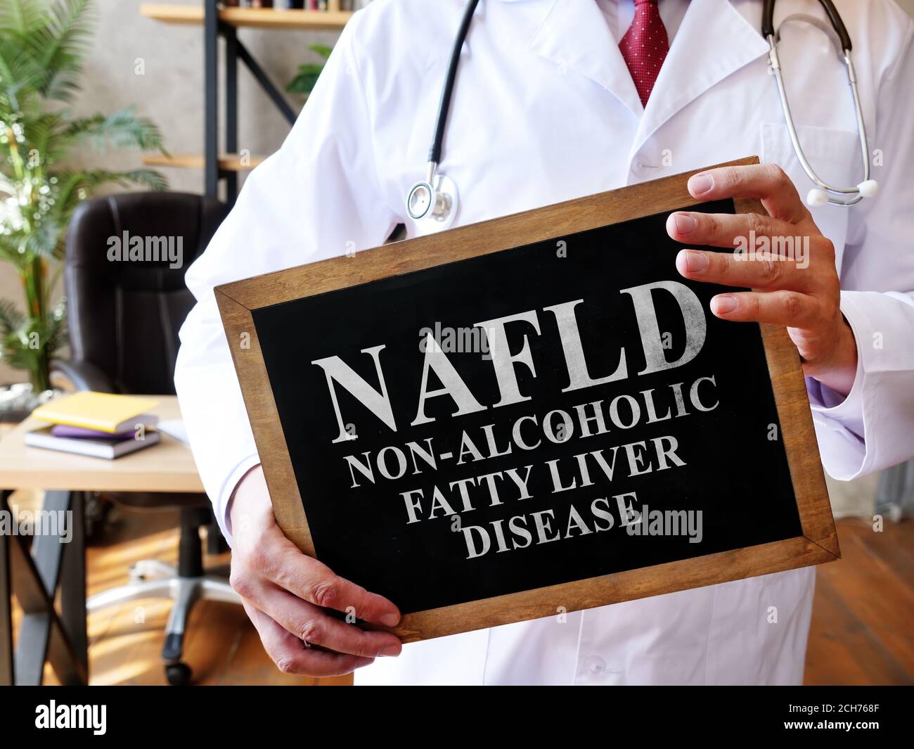 Malattia del fegato grasso non alcolico NAFLD il medico sta tenendo un segno. Foto Stock