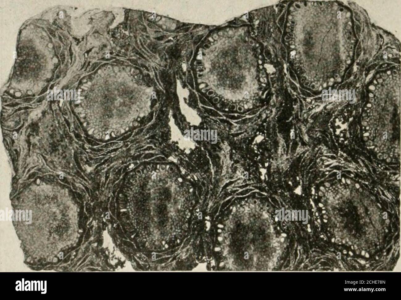 . Ereditarietà ed evoluzione delle piante . FIG. 99.-Cycadeoidea ingens. Restauro di un cono bispor-angiato espanso, o fiore, in sezione quasi longitudinale. Restaurato da fossile asiliciificato. (Dopo Wieland.) bracts disposti in spirali. Le bratte circondavano l'acampanula di circa 20 resistenza. Ogni stampo era, in realtà, una sporofilla finemente composta, lunga circa 4 incheslong, arrotolata verso il centro del fiore, e portare due file di microsporangia composta (polline-sacs) su ciascun foglietto. Essi assomigliavano così strettamente allo sporo-fillo di una felce. 1 i coni di stampaggio di Zamia sono laterali. 2l6 QUI Foto Stock