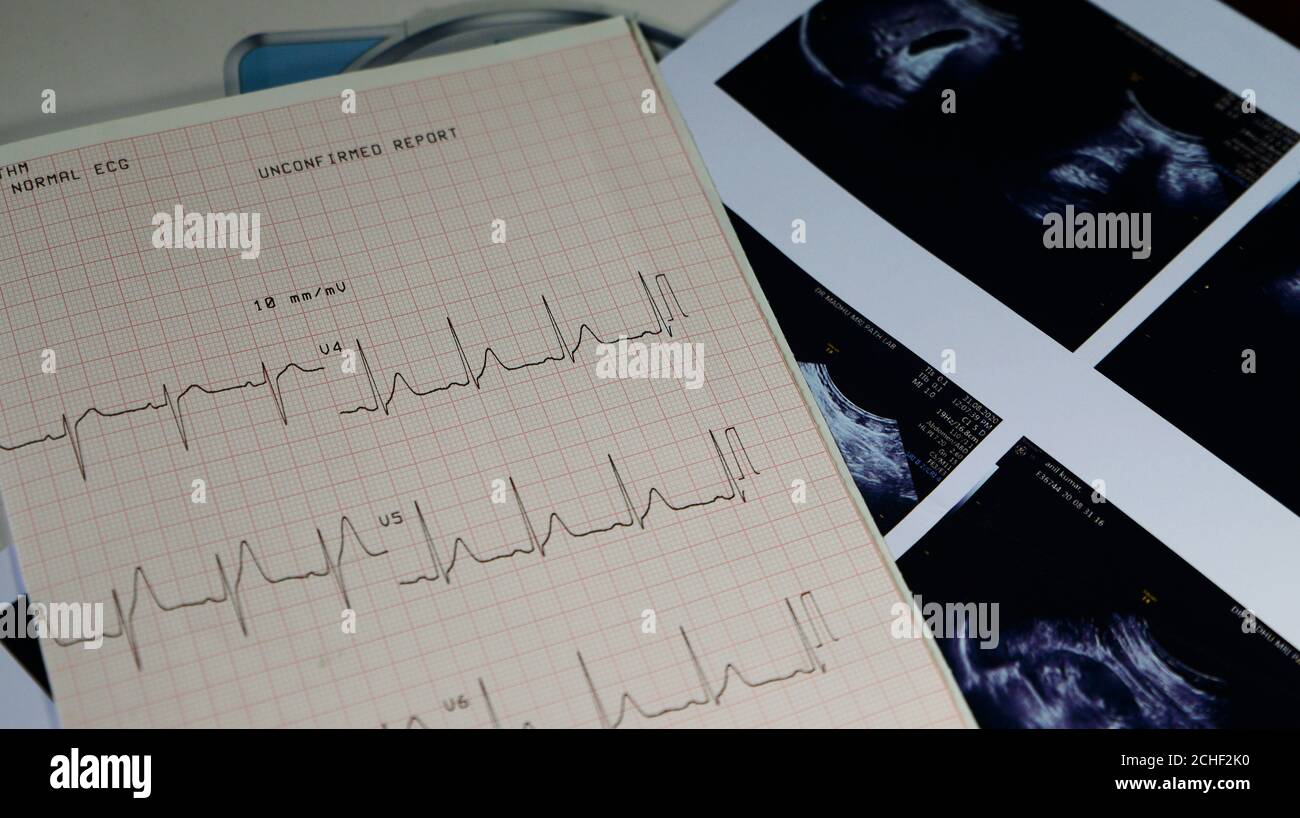 Referto di scansione a ultrasuoni e lettura dell'elettrocardiogramma Foto Stock