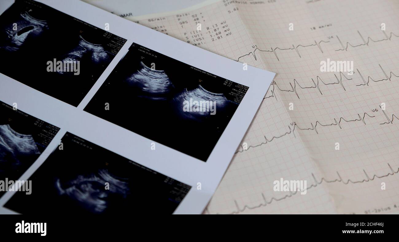 Referto di scansione a ultrasuoni e lettura dell'elettrocardiogramma Foto Stock