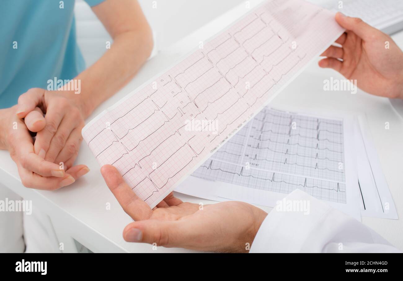 il medico analizza i risultati dell'elettrocardiogramma, primo piano. Diagnosi di aritmia, frequenza cardiaca e malattie cardiache Foto Stock