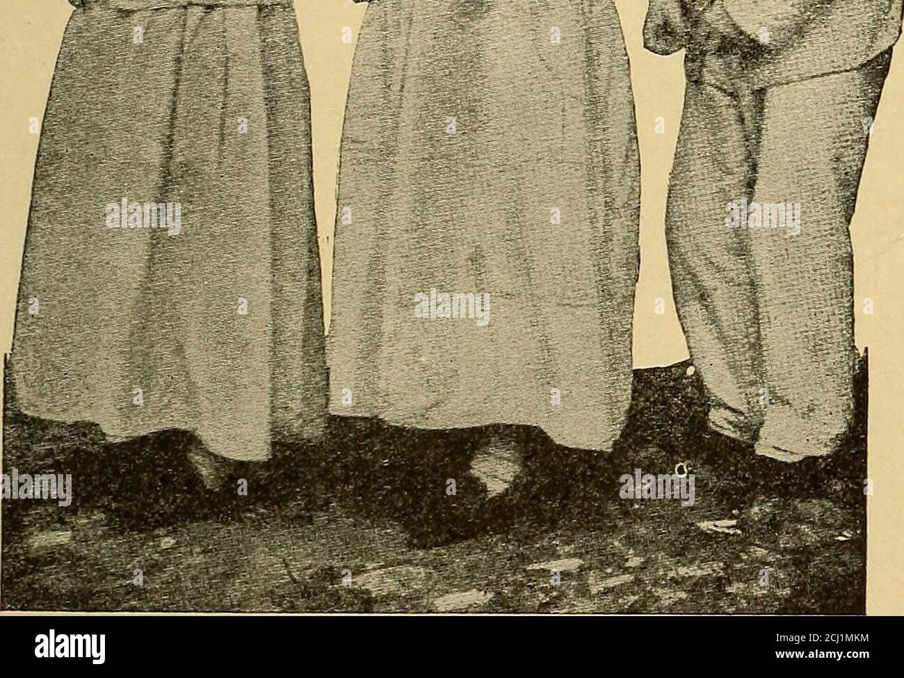 . Diagnosi fisica . Fig. 235.-atteggiamento caratteristico della paralisi Agitans. (Curschmann.) i paralisi possono o non possono mostrare queste associazioni, ma sono spesso accompagnati da disturbi della vescica e del retto. 3. Spasmo, tremore e tremore fibrillare.-(«.) Spasmo meanscontrazione muscolare involontaria. Il famoso cramp è un buon esempio del tipo di spasmo noto come spasmo tonico. In contrasto con questo è lo spasmo clonico, in cui i flessori e gli estensori si contraggono alternativamente per produrre un movimento come quello del nostro avambraccio quando 508 DIAGNOSI FISICA. Agitiamo un fluido in una provetta, o come la AN Foto Stock