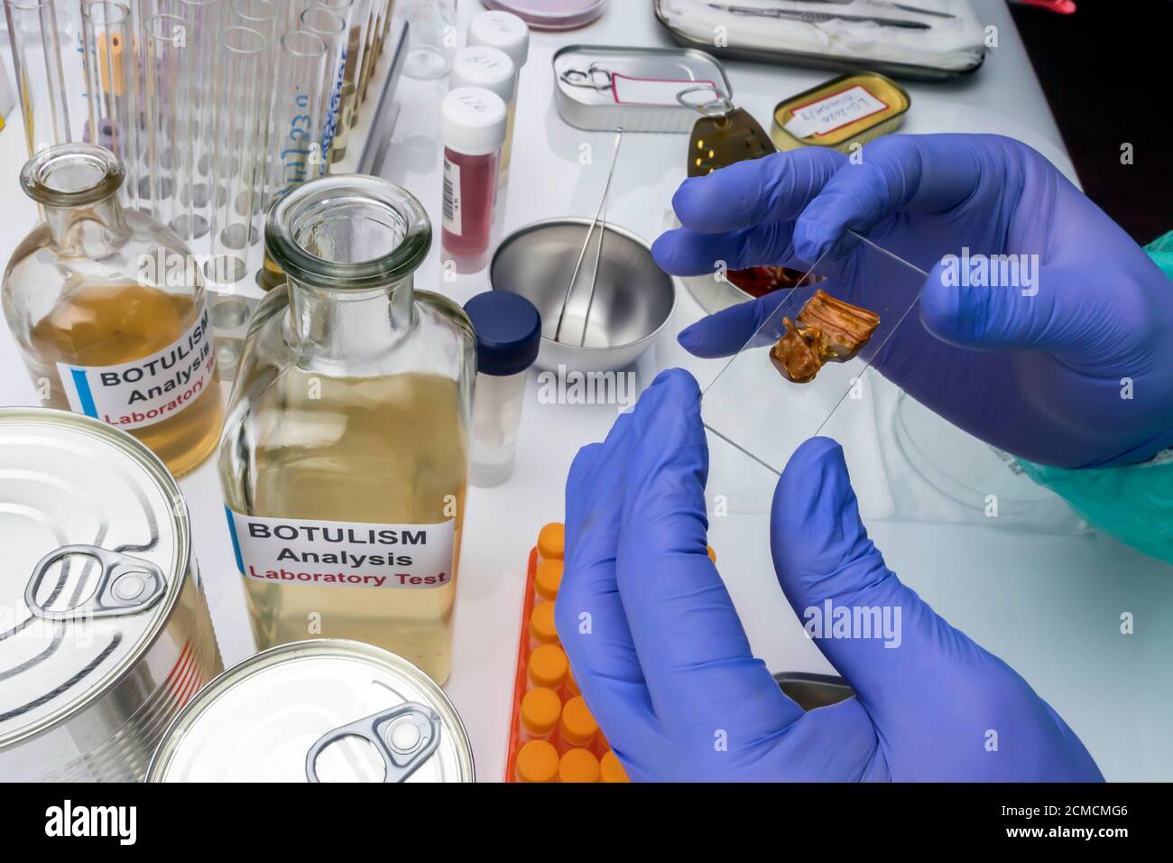 Scienziato di laboratorio esperto che analizza un campione da un cibo in scatola può, infezione botulistica in persone ammalate, immagine concettuale Foto Stock