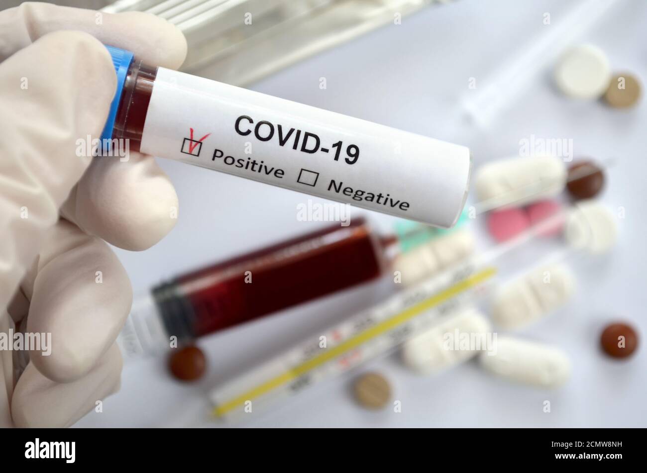 La mano del medico in guanti di gomma contiene un campione di sangue in una provetta con un risultato positivo per COVID-19 su sfondo sfocato Foto Stock