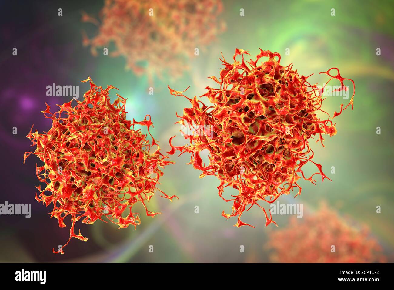 Le cellule del cancro, illustrazione del computer. Foto Stock
